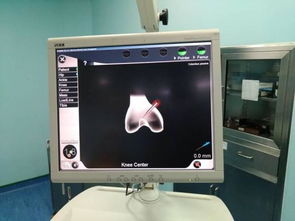 計(jì)算機(jī)輔助導(dǎo)航技術(shù)與移動(dòng)應(yīng)用在膝關(guān)節(jié)置換中的開發(fā)與運(yùn)營體會(huì)